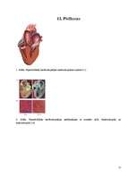 Research Papers 'Hipertrofiskā kardiomiopātija', 17.