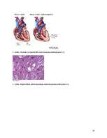 Research Papers 'Hipertrofiskā kardiomiopātija', 18.