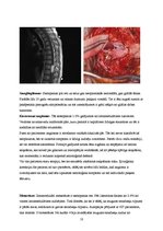 Research Papers 'Muguras smadzeņu anatomija un to audzēju veidi', 10.
