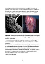 Research Papers 'Muguras smadzeņu anatomija un to audzēju veidi', 11.