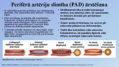 Presentations 'Perkutāna translumināla angioplastika', 2.