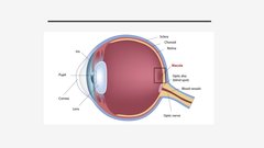 Presentations 'Makulas deģenerācija', 3.