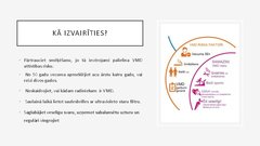 Presentations 'Makulas deģenerācija', 8.