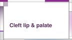Presentations 'Cleft Lip and Palate', 1.