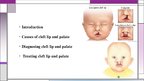 Presentations 'Cleft Lip and Palate', 3.