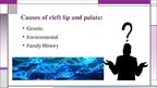 Presentations 'Cleft Lip and Palate', 5.