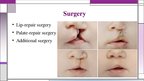 Presentations 'Cleft Lip and Palate', 9.