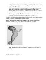 Research Papers 'Bilirubīna metabolisms un neirotoksicitāte jaundzimušajiem', 6.