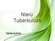 Presentations 'Nieru tuberkuloze', 1.