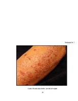 Research Papers 'UV staru ietekme uz cilvēka ādu un organismu', 26.