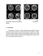 Research Papers 'Neiroķirurģijas attīstības vēsture Paula Stradiņa klīniskās universitātes slimnī', 8.