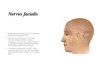 Presentations 'Nervus facialis parēze', 2.