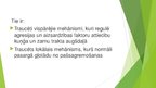 Presentations 'Kuņģa un divpadsmitpirkstu zarnas čūla', 5.