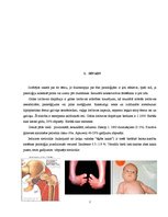 Research Papers 'Fizioterapija pie displāzijas, torticollis, greizās pēdas', 2.