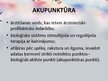 Presentations 'Akupunktūra', 4.