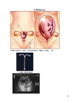 Research Papers 'Grūtniecības pazīmes, kontracepcijas metodes vēsturē, attieksme pret abortu ārva', 25.