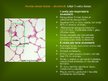 Presentations 'Alveola, surfaktanta veidošanās un noārdīšanās, aerohematoloģiskā barjeras morfo', 5.
