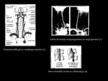 Presentations 'Vertebrālās artērijas sindroms', 8.