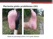 Presentations 'Diabētiskās pēdas aprūpe', 9.