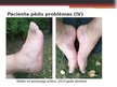 Presentations 'Diabētiskās pēdas aprūpe', 10.