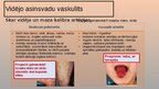 Presentations 'Vaskulīti', 6.