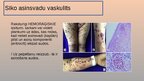 Presentations 'Vaskulīti', 8.