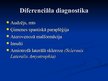 Presentations 'Demielinizējošās centrālās nervu sistēmas slimības', 26.