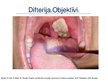 Presentations 'Angīnu diferenciāldiagnostika: angīna/difterija', 21.