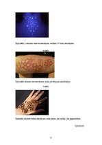 Research Papers 'Tetovējumu ietekme uz cilvēku veselību', 31.