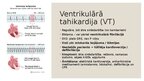 Presentations 'Dzīvībai bīstamas aritmijas', 5.