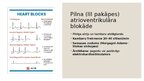 Presentations 'Dzīvībai bīstamas aritmijas', 12.