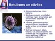 Presentations 'Botulisms', 5.