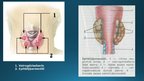 Presentations 'Endokrīnā sistēma', 23.
