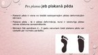 Presentations 'Kāju un pēdu deformācijas. Ārstēšana, fizioterapija', 9.