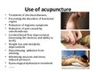 Presentations 'Acupuncture', 5.