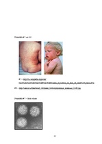 Research Papers 'Bērnu infekcijas slimības', 26.