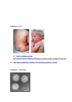 Research Papers 'Bērnu infekcijas slimības', 31.