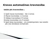 Presentations 'Šosejas transports - kravas automobiļi', 10.