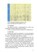 Research Papers 'Elektroencefalogrammas reģistrēšanas metodika, izmantojot datorprogrammu Win EEG', 12.