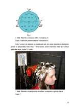 Research Papers 'Elektroencefalogrammas reģistrēšanas metodika, izmantojot datorprogrammu Win EEG', 23.