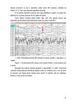 Research Papers 'Elektroencefalogrammas reģistrēšanas metodika, izmantojot datorprogrammu Win EEG', 29.
