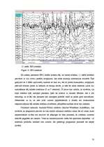 Research Papers 'Elektroencefalogrammas reģistrēšanas metodika, izmantojot datorprogrammu Win EEG', 30.