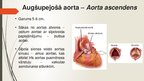 Presentations 'Aorta', 11.