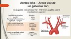 Presentations 'Aorta', 13.