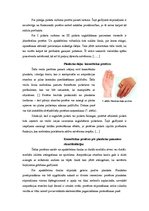 Research Papers 'Pirkstu un plaukstas daļas protezēšana', 8.