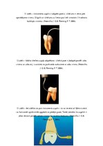 Term Papers 'Ultraskaņas aparātu lietošana zobu higiēnistu darbā', 19.