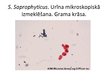 Presentations 'Staphylococcus saprophyticus baktērijas', 5.