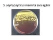 Presentations 'Staphylococcus saprophyticus baktērijas', 6.