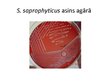Presentations 'Staphylococcus saprophyticus baktērijas', 7.