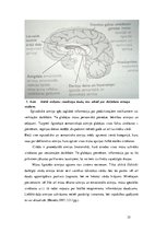 Term Papers 'Mūzikas terapijas ietekme insulta pacientiem valodas un atmiņas traucējumu mazin', 35.
